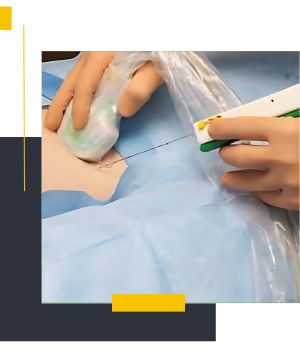 مزایای بیوپسی برست مزایای بیوپسی برست